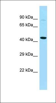 Anti-PFKFB4 antibody produced in rabbit