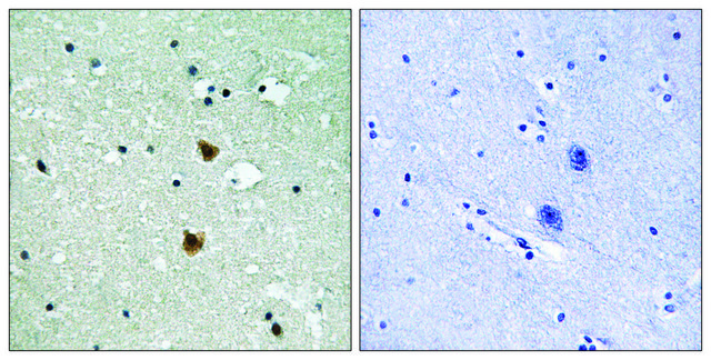 Anti-HSP27 antibody produced in rabbit
