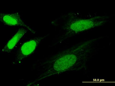Monoclonal Anti-SLIC1, (C-terminal) antibody produced