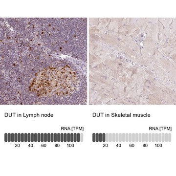 Anti-DUT antibody produced in rabbit
