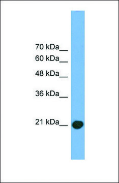 Anti-COMMD8 antibody produced in rabbit
