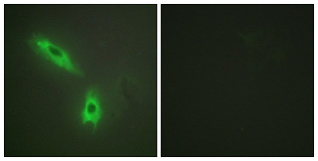 Anti-TNFC antibody produced in rabbit