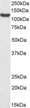 Anti-SMARCA3 antibody produced in goat