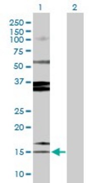 Anti-SPINK1 antibody produced in rabbit