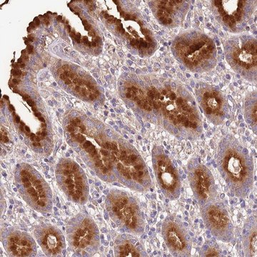 Anti-EXD3 antibody produced in rabbit