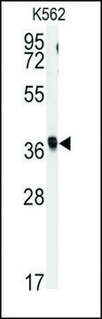Anti-RFC2 (N-term) antibody produced in