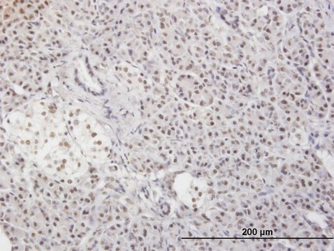 Monoclonal Anti-MLF2 antibody produced in