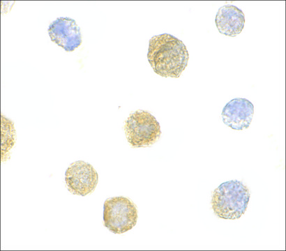 Anti-ADAP (ab1) antibody produced in