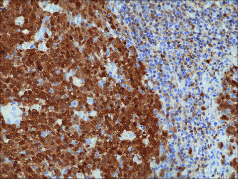 Anti-BOB-1/OBF-1 antibody, Rabbit monoclonal