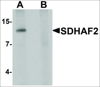 Anti-SDHAF2 antibody produced in chicken