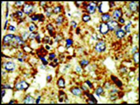 Anti-SET07 antibody produced in rabbit