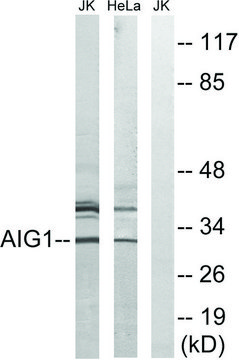 Anti-AIG1 antibody produced in rabbit