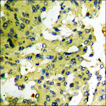Anti-phospho-MAP3K1 (pThr¹??²) antibody produced in