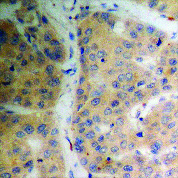 Anti-phospho-SGK (pSer??) antibody produced in