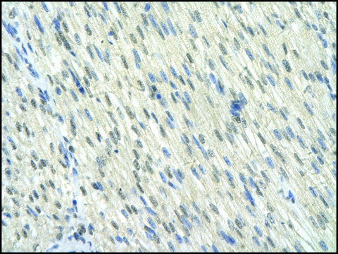 Anti-KLF10 antibody produced in rabbit