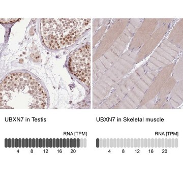 Anti-UBXN7 antibody produced in rabbit