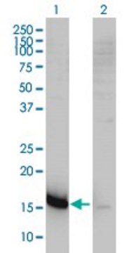 Monoclonal Anti-CMTM5 antibody produced in