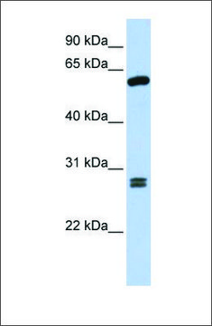 Anti-ACD antibody produced in rabbit