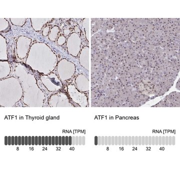 Anti-ATF1 antibody produced in rabbit
