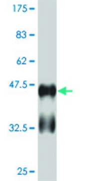 ANTI-RUNX2 antibody produced in mouse