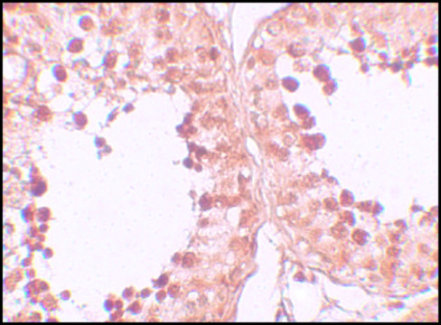 Anti-CRISP2 antibody produced in rabbit