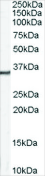 Anti-Calretinin antibody produced in goat