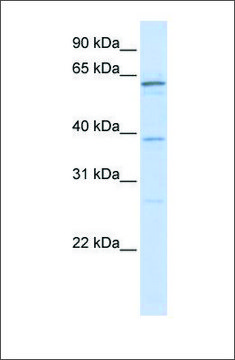 Anti-RBM39 antibody produced in rabbit
