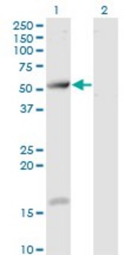 Monoclonal Anti-TCP11 antibody produced in