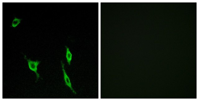 Anti-DCC antibody produced in rabbit