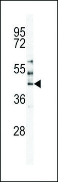 ANTI-MST3(C-TERMINAL) antibody produced in rabbit