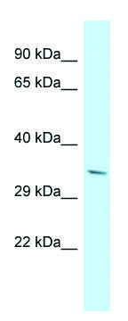 Anti-PDLIM7 (N-terminal) antibody produced in