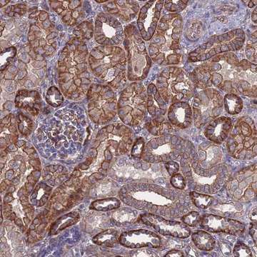 Anti-NDUFAF6 antibody produced in rabbit