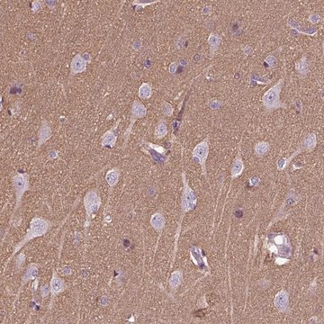 Anti-HAGHL antibody produced in rabbit