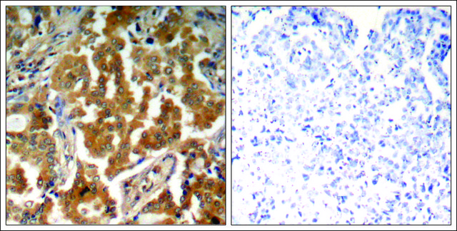 Anti-phospho-ADD1 (pSer?²?) antibody produced in