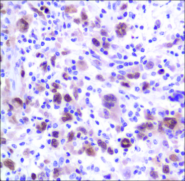 Anti-MUM1/IRF4 antibody, Rabbit monoclonal