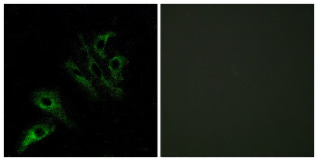 Anti-TNFL4 antibody produced in rabbit