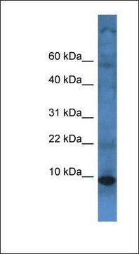 Anti-TMEM141 antibody produced in rabbit