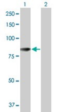 Anti-ACSL5 antibody produced in rabbit