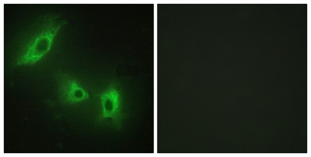 Anti-ACV1B antibody produced in rabbit