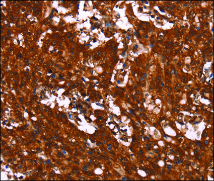 Anti-HCAR2 antibody produced in rabbit