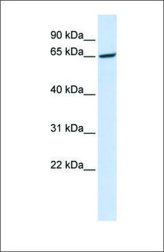 Anti-GPR177 antibody produced in rabbit