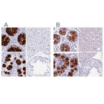 Anti-CLCA1 antibody produced in rabbit