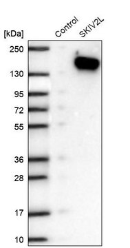 Anti-SKIV2L antibody produced in rabbit
