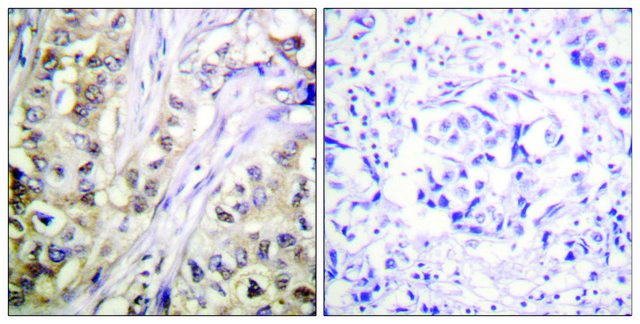 Anti-Survivin antibody produced in rabbit