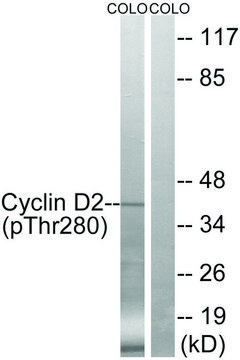 Anti-Cyclin D2 (Phospho-THR280)