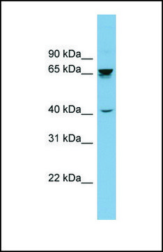 Anti-ACHE antibody produced in rabbit