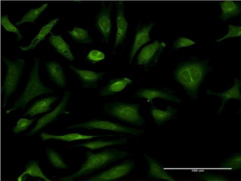 Monoclonal Anti-CSAD antibody produced in