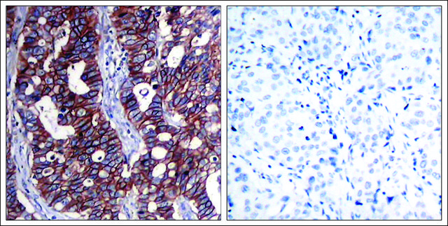 Anti-ERBB2 (Ab-1221/1222) antibody produced in