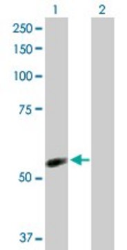 Anti-NDOR1 antibody produced in rabbit