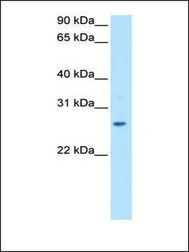 Anti-CRISP1 antibody produced in rabbit